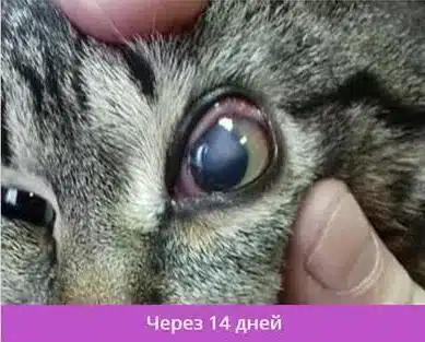 Травма левого глаза, язва вследствие герпеса, через 14 дней